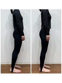 レナセール FUK 福岡店(RENACER FUK)/姿勢の変化