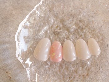 アロイ 幕張(arroi)/パラジェル/フィルイン/真砂