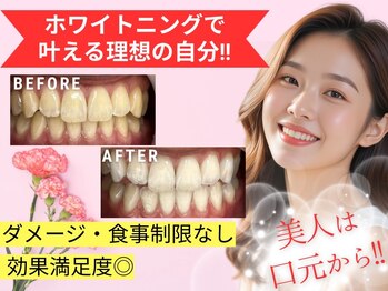 LBSホワイトニング 渋谷店