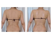 ムーンブロッサム(MoonBlossom)/ブライダルエステ120分