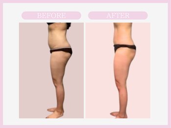 アコガレコガオ 秋田店/