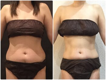 美容整体ウェリナ 名駅院/小顔矯正/骨盤矯正/美脚サロン