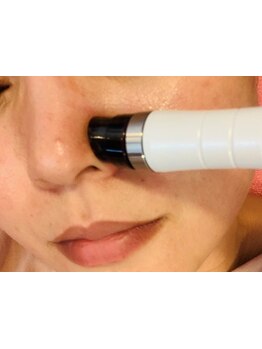 毛穴ケアをしたい