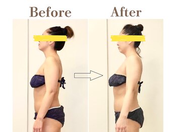 フィオーレ 麻布十番(Fiore)/全身ケア後の姿勢変化(上半身)