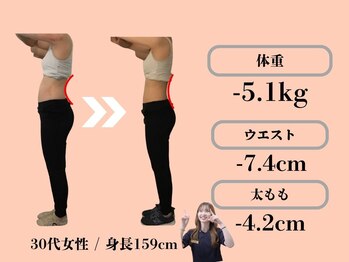 エステティックトレーニングサロン ボディネイト(Body Nate)/Before/After