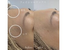 ルピナス(Lupinus)の雰囲気（圧倒的美白とハリが手に入る☆お肌の土台を作るワックスです♪）