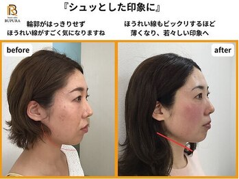 ブプラ 新山口店(BUPURA)/before→after