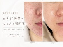 アネラボーテ(Anela Beaute)の雰囲気（毛穴・ニキビ・肌荒れ・くすみ｜肌質改善はお任せください！）