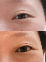 バードアイ(bird eye)/ラッシュリフト(まつ毛パーマ)