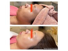 はぐくむ(Hagukumu)の雰囲気（オーダーメイド施術tでなりたいお肌へ☆）