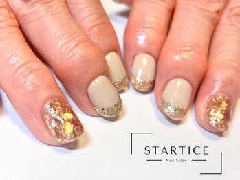 スターチス(STARTICE)/定額シンプルコース