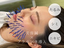モンダロ(MONDARO)