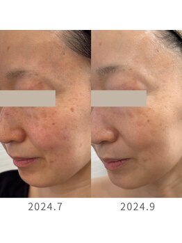 アズール(AZUL)/トーンアップもお任せください！