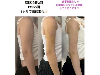 スリム(SLIM by lily of the valley)の写真