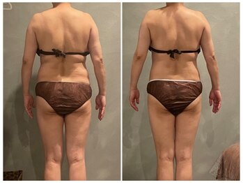 ツーアップ(2up)/腰回り肉1回