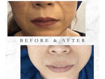 ルチノ(LUTINO)/話題のGrotty正規取り扱いサロン