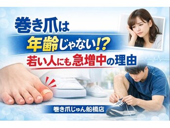 巻き爪じゅん 千葉駅前店/巻き爪は年齢より〇〇！？