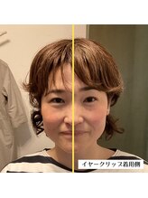 甲陽園鍼灸わたぐも/クリップアップ着用変化