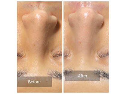 グリーンノート(GREEN NOTE)の写真