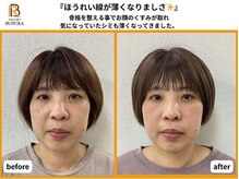 ブプラ 新山口店(BUPURA)/before→after