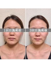 シェア 人形町店(Chare)/【小顔・骨盤矯正・О脚・整体】
