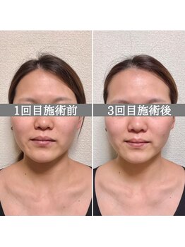 シェア 人形町店(Chare)/【小顔・骨盤矯正・О脚・整体】