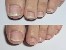 阿良波々岐(アラハバキ)/フットケア70分コース