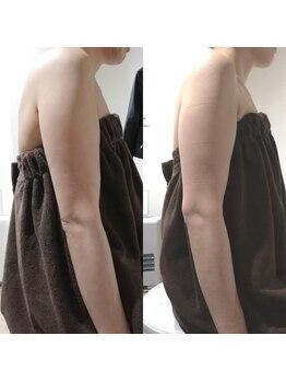 RiとBiのたまご/(ブライダル)初回と４回目