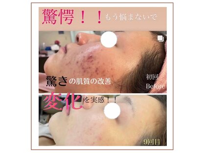 エーオーバー(A over')の写真