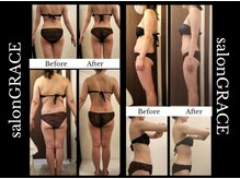 サロン グレイス(salon GRACE)