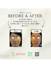 スーフラワー(SOO-flower)/まずは始めてみませんか？