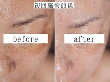 ユウビジン(YOU美人)/エイジングサイン一掃