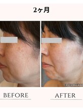 ハートエルボー(Heart elbow)/ノーメイクの素肌の方が美しく！