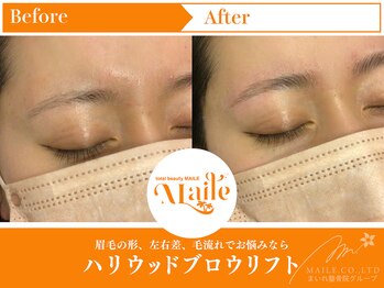 まいれ鍼灸院整骨院 整体院 草津院/ハリウッドブロウリフト/美眉