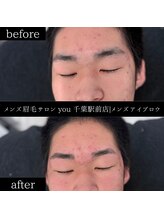 ユー 千葉駅前店(you)/ビフォ－アフター写真