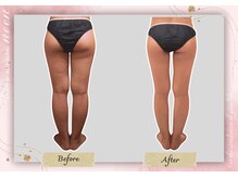 ヌーン(noon)/足のむくみを解消