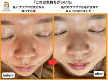 ブプラ 新山口店(BUPURA)/before→after