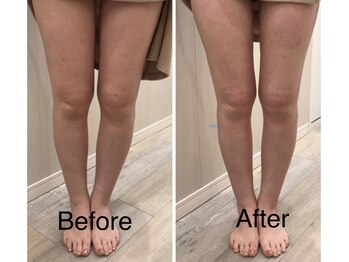 エクルビューティーツー(ECRU Beauty 2)/フォースカッター美脚