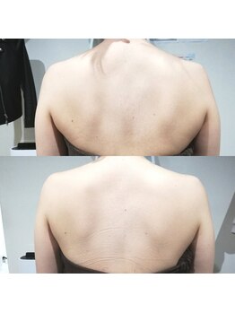 RiとBiのたまご/(ブライダル)初回と４回目