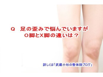 小池整体院/足O脚とX脚の違いは？