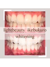ライトビューティー 池袋店(LightBeauty)/症例写真