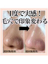 ルネッタ(Lunetta)/