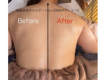 スキンフェイス(skin face)の写真