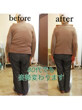 カイロプラクティック 整体 三日月/姿勢の変化　80代の方です