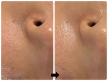 エフェクト 塚口店(effect)/Before After