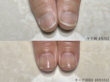 ロイネイル 鹿嶋店(LOInail)/育成3ヶ月コース