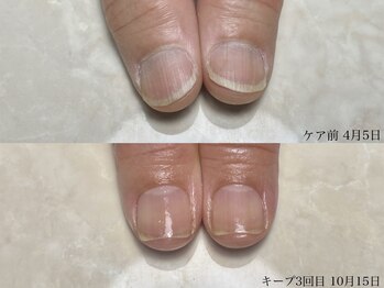 ロイネイル 鹿嶋店(LOInail)/育成3ヶ月コース