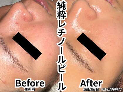 レイル(REIR)の写真