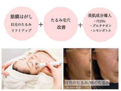 ネージュ(Neige)の写真