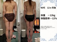 ヨサパーク ブリス(YOSA PARK blis)/40代　12ヶ月